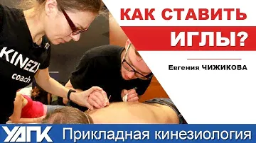 Как ставить иглы правильно? (Е.Чижикова)
